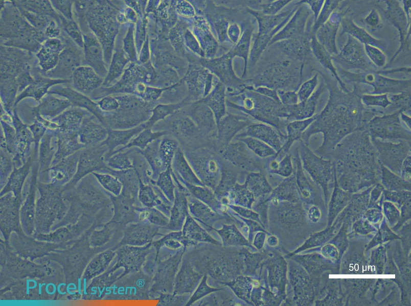 Mouse Cardiac Microvascular Pericytes - 6