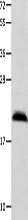 Western Blot analysis of Mouse brain tissue using FGF12 Polyclonal Antibody at dilution of 1:450