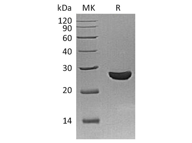 Recombinant Schistosoma Japonicum GST 26 Protein