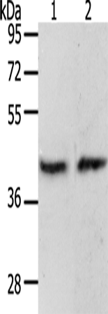 Western Blot analysis of MCF7 cell and Mouse brain tissue using PAX8 Polyclonal Antibody at dilution of 1:250