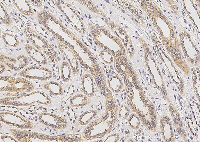 RAGE/AGER Monoclonal Antibody-searchlist-1