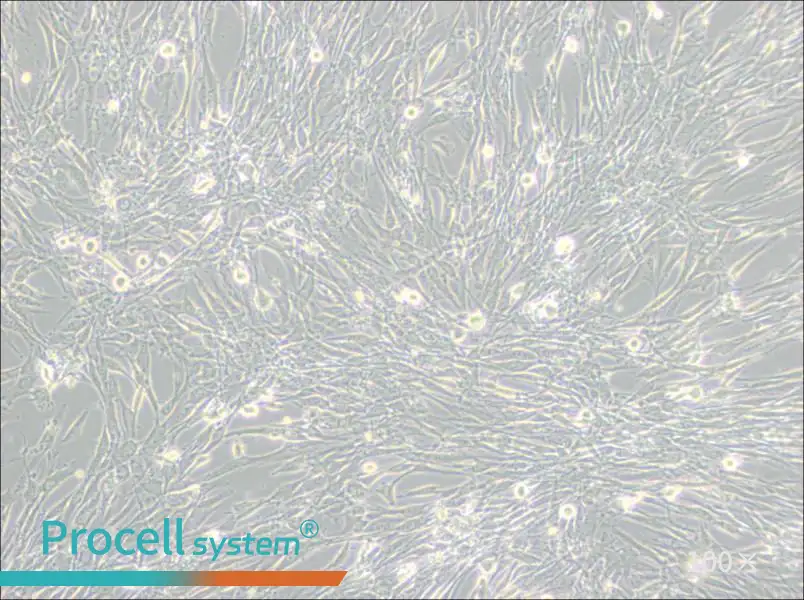 U-118 MG Cell Complete Medium - 3