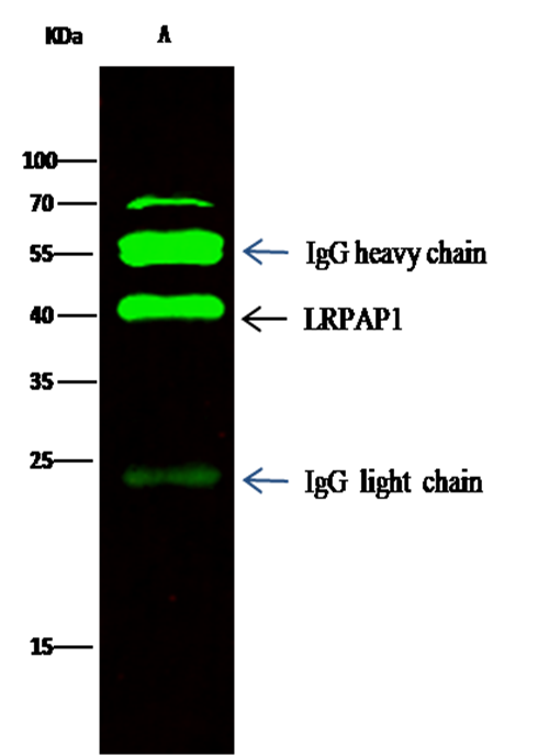 Recombinant LRPAP1/A2MRAP Monoclonal Antibody