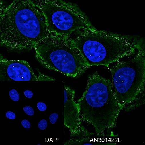 Recombinant TSHB Monoclonal Antibody - small - 4