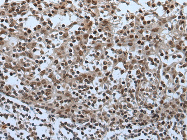 Immunohistochemistry of paraffin-embedded Human tonsil tissue  using CELF5 Polyclonal Antibody at dilution of 1:65(?200)