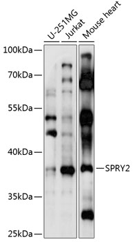 Western blot analysis of extracts of various cell lines using SPRY2 Polyclonal Antibody at 1:1000 dilution.