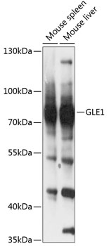 Western blot analysis of extracts of various cell lines using GLE1 Polyclonal Antibody at 1:3000 dilution.