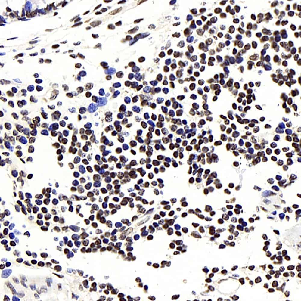 Immunohistochemistry analysis of paraffin-embedded human colon  using NFKBIB Polyclonal Antibody at dilution of 1:300.