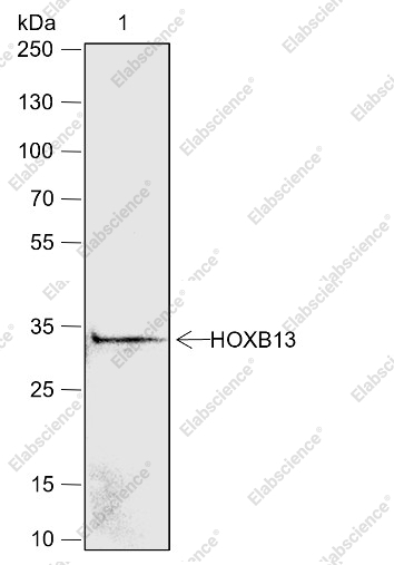 Recombinant HOXB13 Monoclonal Antibody - 2
