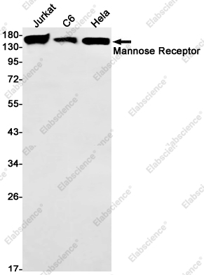 Recombinant Mannose Receptor Monoclonal Antibody - 1