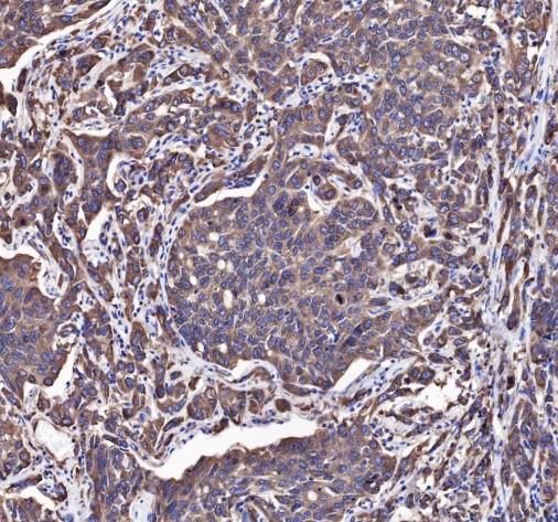 Recombinant eIF4G1 Monoclonal Antibody - small - 3