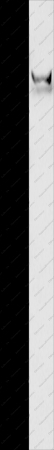 GRIN2B Polyclonal Antibody - 1