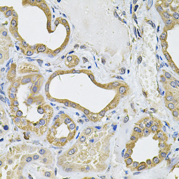 Immunohistochemistry of paraffin-embedded Human kidney using ICOSL Polyclonal Antibody at dilution of 1:100 (40x lens).