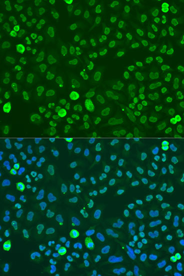 Immunofluorescence analysis of U2OS cells using SAFB Polyclonal Antibody at dilution of  1:100. Blue: DAPI for nuclear staining.