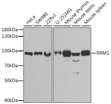 Western blot analysis of extracts of various cell lines using RRM1 Polyclonal Antibody at dilution of 1:1000.