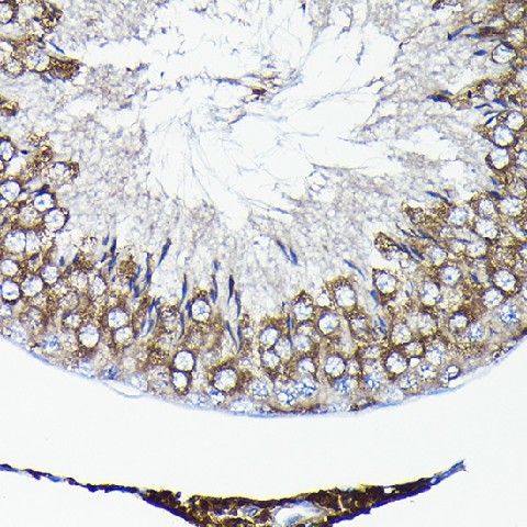 Immunohistochemistry of paraffin-embedded rat testis using TCP1 Polyclonal Antibody at dilution of 1:100 (40x lens).Perform high pressure antigen retrieval with 10 mM citrate buffer pH 6.0 before commencing with IHC staining protocol.