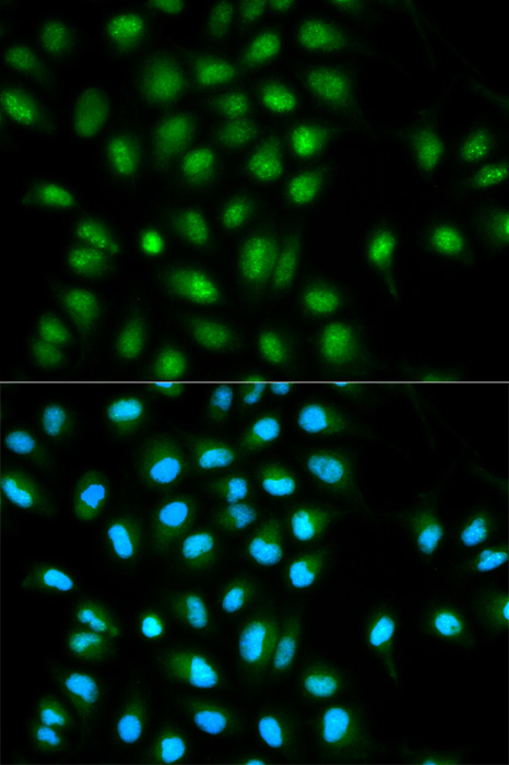 Immunofluorescence analysis of HeLa cells using ASC / TMS1 Polyclonal Antibody