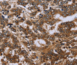 FH Polyclonal Antibody - 2