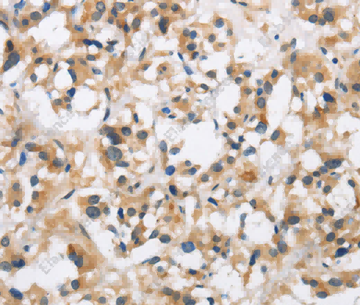 CKMT2 Polyclonal Antibody - 3