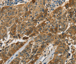 Cathepsin E Polyclonal Antibody - 2