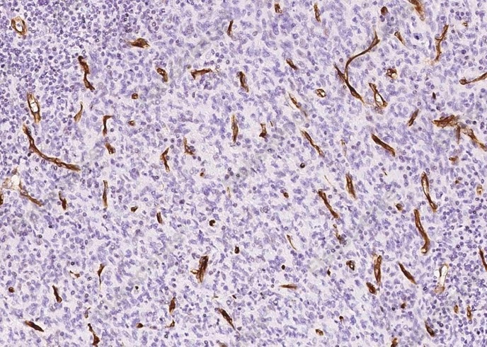 Nestin/NES Monoclonal Antibody - 3