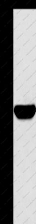 HMGCS1 Polyclonal Antibody - 1
