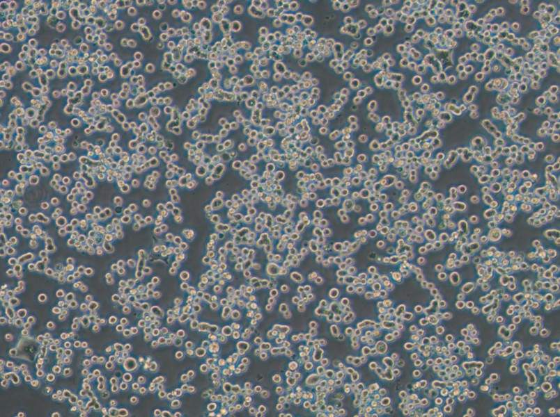 MDA-MB-134-VI (L15) Cell Complete Medium - 2