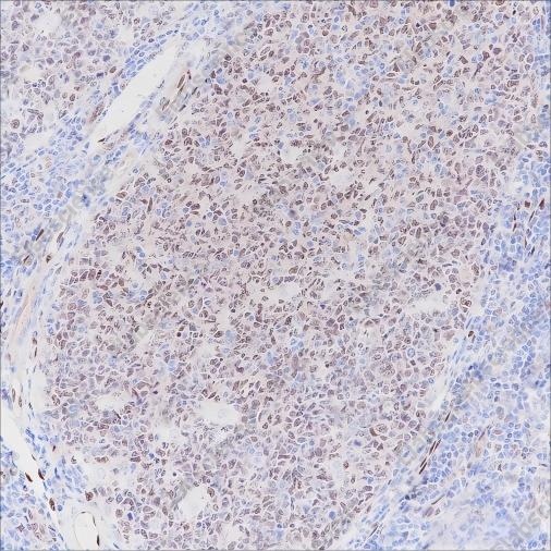 Recombinant LMO2 Monoclonal Antibody - 1