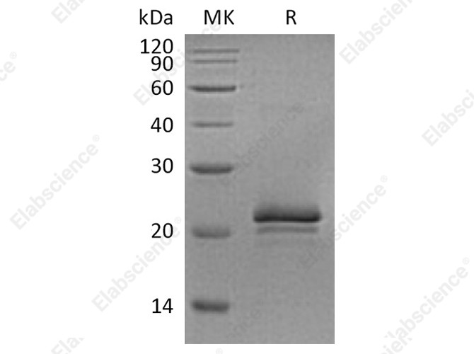 Recombinant Rat VEGF-A/VEGF164 Protein - 1