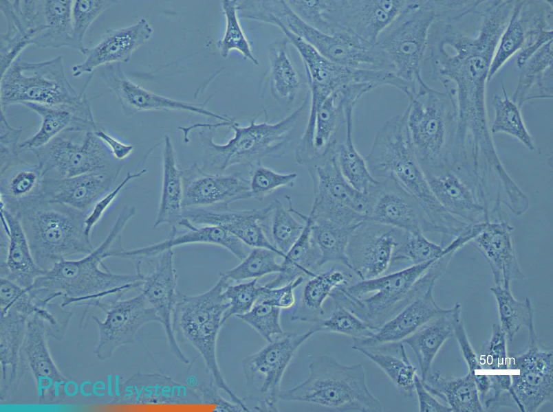 Mouse Prostate Fibroblast Complete Medium - 5