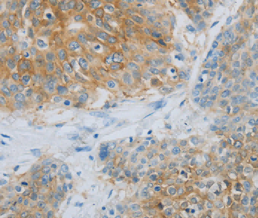 NDRG1 Polyclonal Antibody - 3