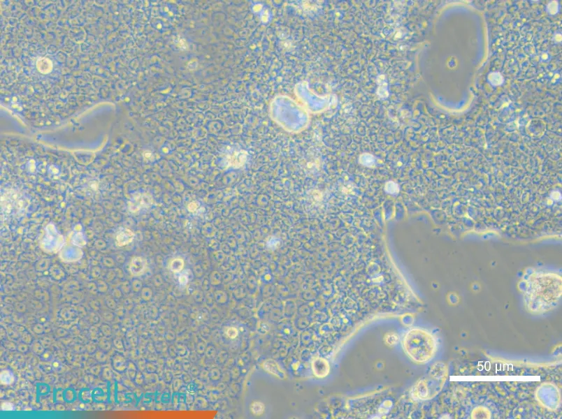 NCI-N87 [N87] - 5