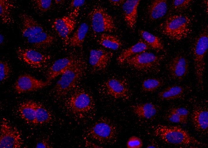 Recombinant Angiopoietin-2/ANG 2 Monoclonal Antibody-searchlist-1