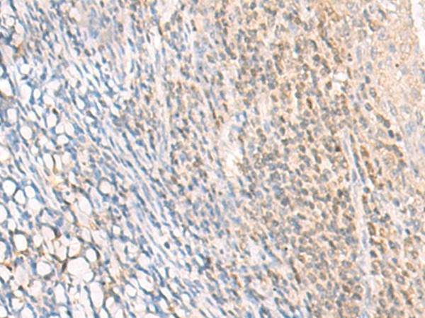 EPSTI1 Polyclonal Antibody - small - 2