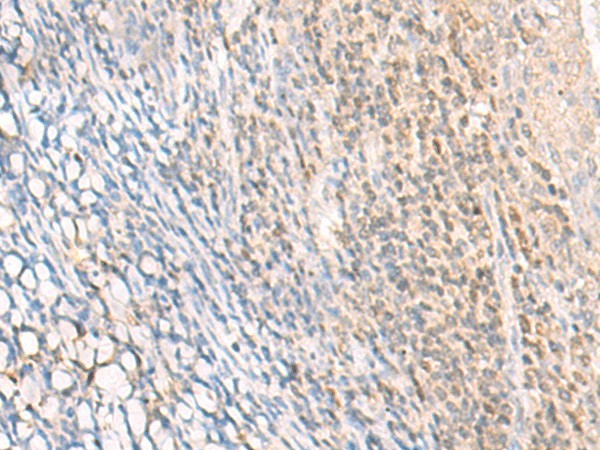 Immunohistochemistry of paraffin-embedded Human tonsil tissue  using EPSTI1 Polyclonal Antibody at dilution of 1:25(?200)