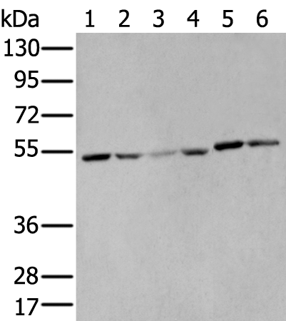 Western Blot analysis of PC3 cell and Mouse muscle tissue, A375 cell using MMP1 Polyclonal Antibody at dilution of 1:500