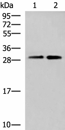 Western blot analysis of A549 cell and Human cerebrum tissue lysates  using TBCB Polyclonal Antibody at dilution of 1:500