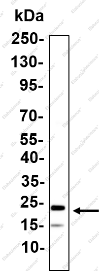 Recombinant TIMP-3 Monoclonal Antibody - 2