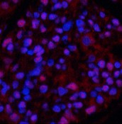 Immunofluorescence analysis of Rat kidney tissue using beta Tubulin Polyclonal Antibody at dilution of 1:200.