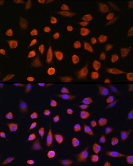 Immunofluorescence analysis of L929 cells using EDEM2 Polyclonal Antibody at dilution of 1:100. Blue: DAPI for nuclear staining.