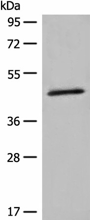 Western blot analysis of K562 cell lysate  using HMBS Polyclonal Antibody at dilution of 1:450