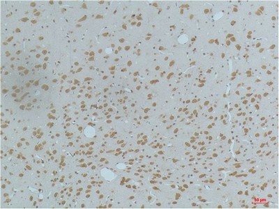 Immunohistochemistry of paraffin-embedded Rat brain tissue using Phospho-CAMK2 beta/gamma/delta (Thr287) Monoclonal Antibody at dilution of 1:200.