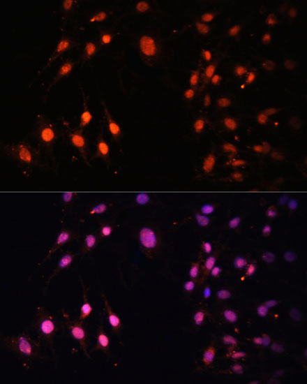 Immunofluorescence analysis of C6 cells using SETD2 Polyclonal Antibody at dilution of  1:100 (40x lens). Blue: DAPI for nuclear staining.