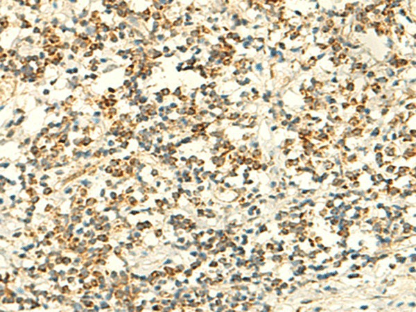 Immunohistochemistry of paraffin-embedded Human tonsil tissue  using IFT27 Polyclonal Antibody at dilution of 1:50(?200)