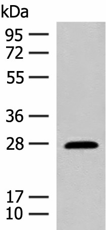 Western blot analysis of Mouse eye tissue lysate  using GUCA1B Polyclonal Antibody at dilution of 1:500