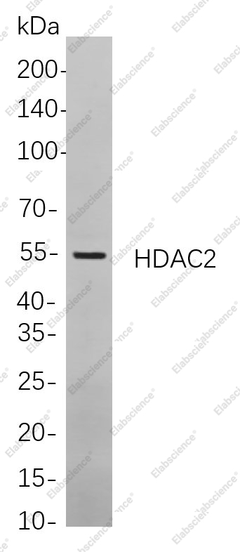 Recombinant HDAC2 Monoclonal Antibody - 1