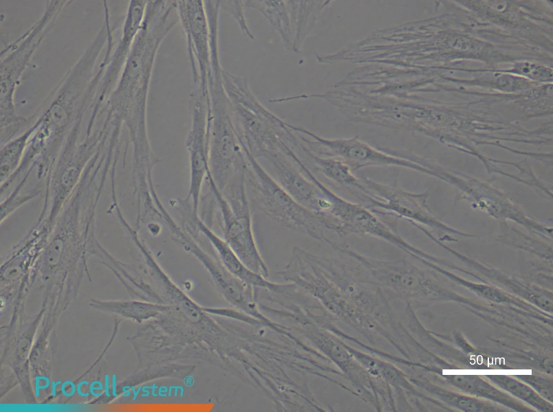 Human Synovial Fibroblast (rheumatoid arthritis) Complete Medium - 5