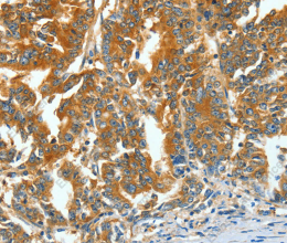 ASNS Polyclonal Antibody - 3