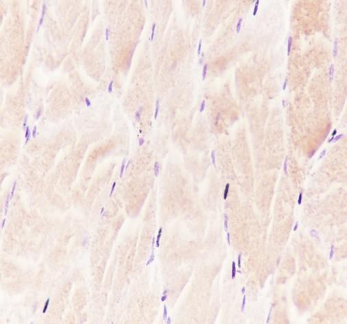 Recombinant alpha Actinin 2 Monoclonal Antibody - small - 4
