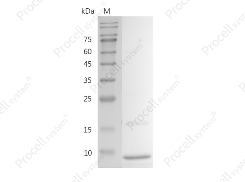 IGF-I/Somatamedin C/IGF-IA, Human, Recombinant